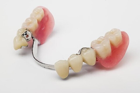 Chrome Dentures 1