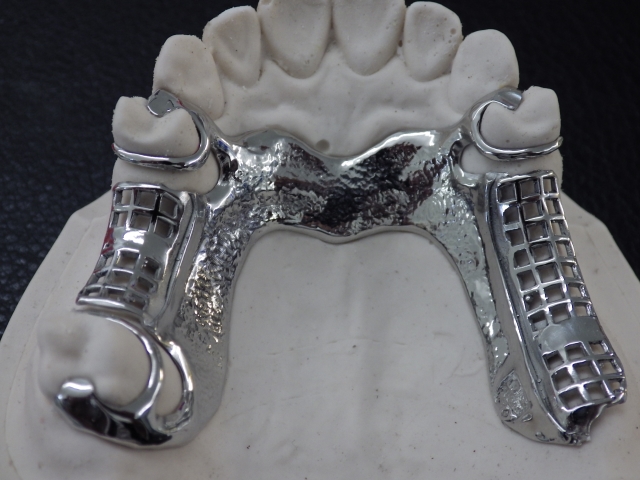 Chrome Dentures 2